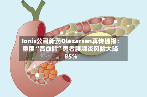 Ionis公司新药Olezarsen再传捷报：重度“高血脂”患者胰腺炎风险大降85%-第2张图片